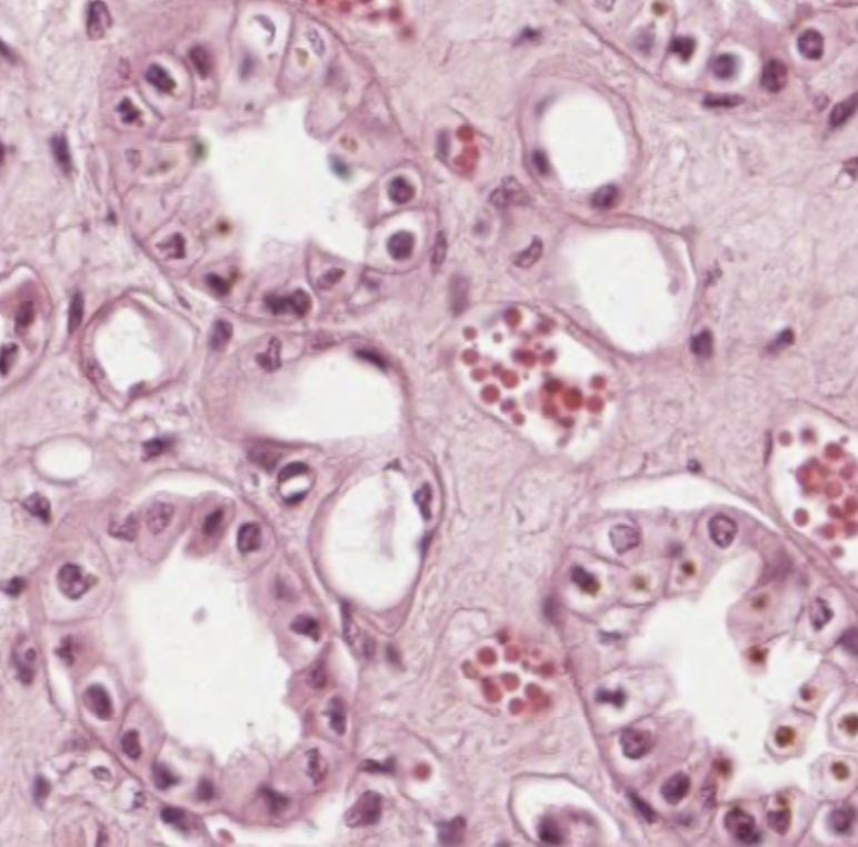 Simple cuboidal epithelium