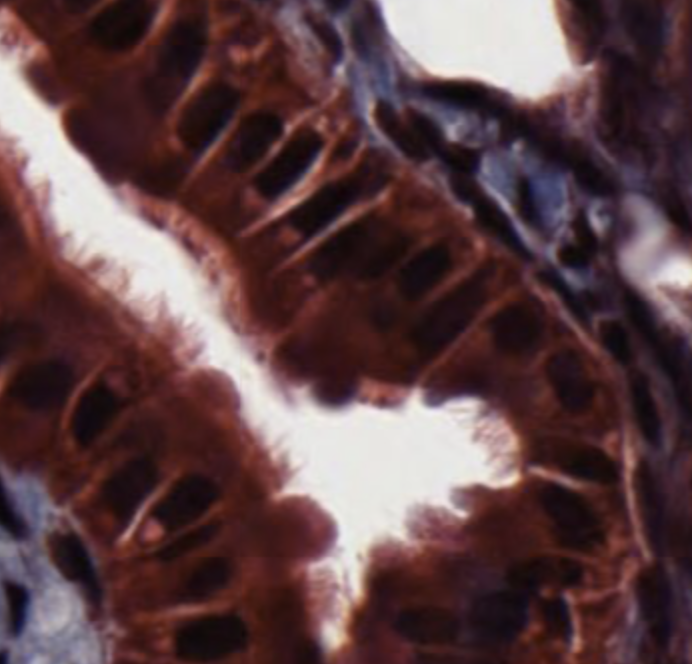 Simple columnar epithelium