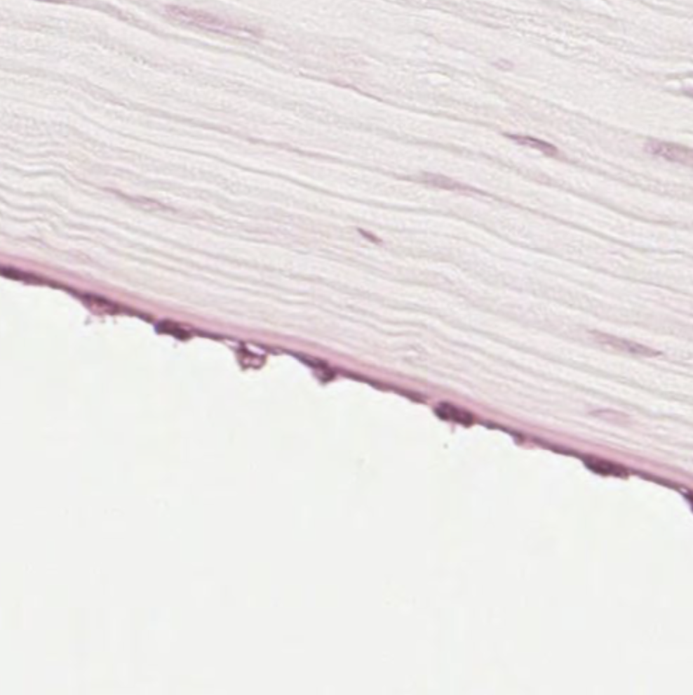 Simple squamous epithelium