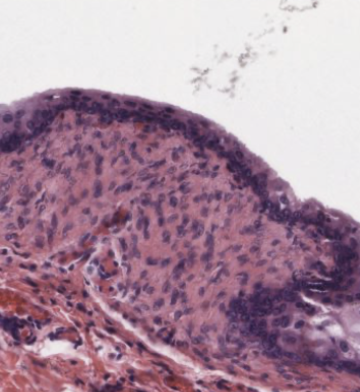 transitional epithelium